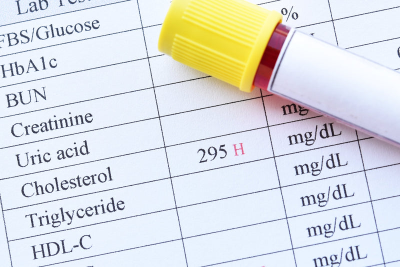 What can affect your blood test results?